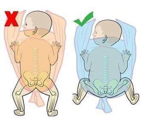 posición de ranita porteo ergonomico 